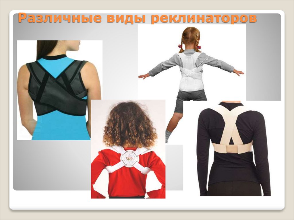 Различные виды реклинаторов