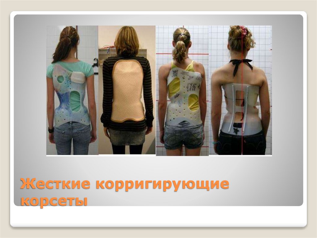 Жесткие корригирующие корсеты