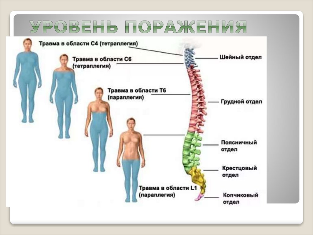 Уровень поражения