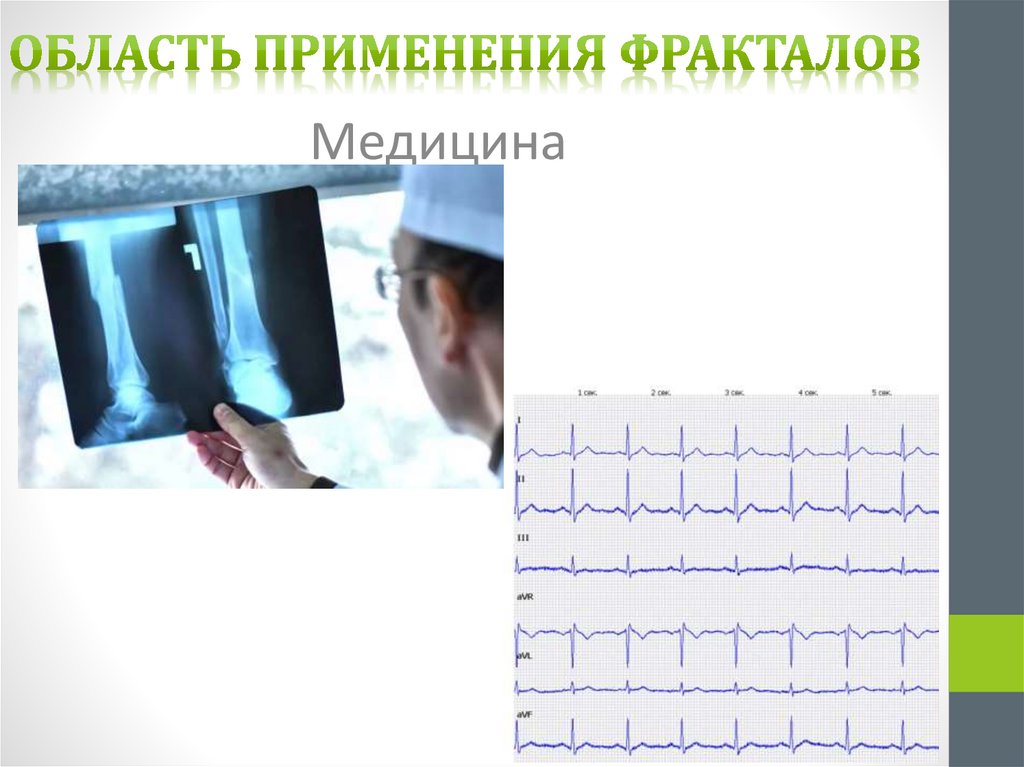 Область применения фракталов