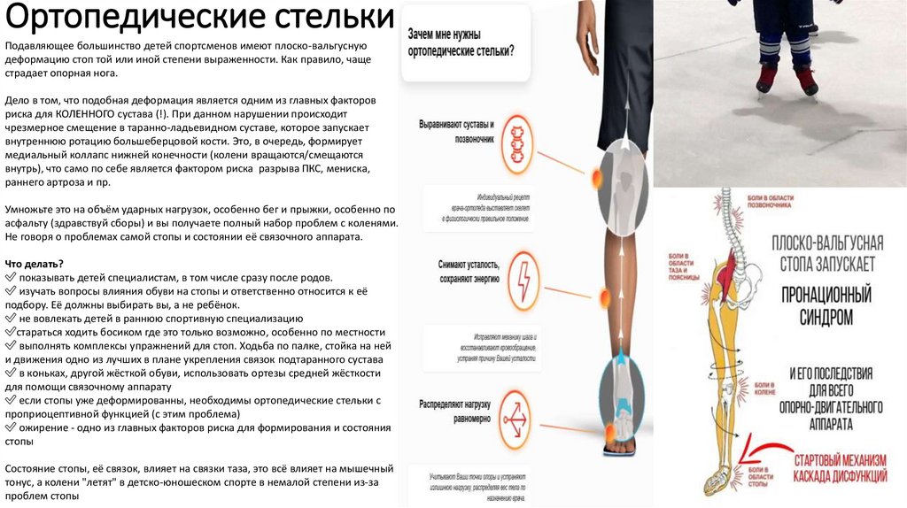 Ортопедические стельки