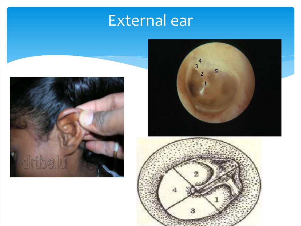 External ear