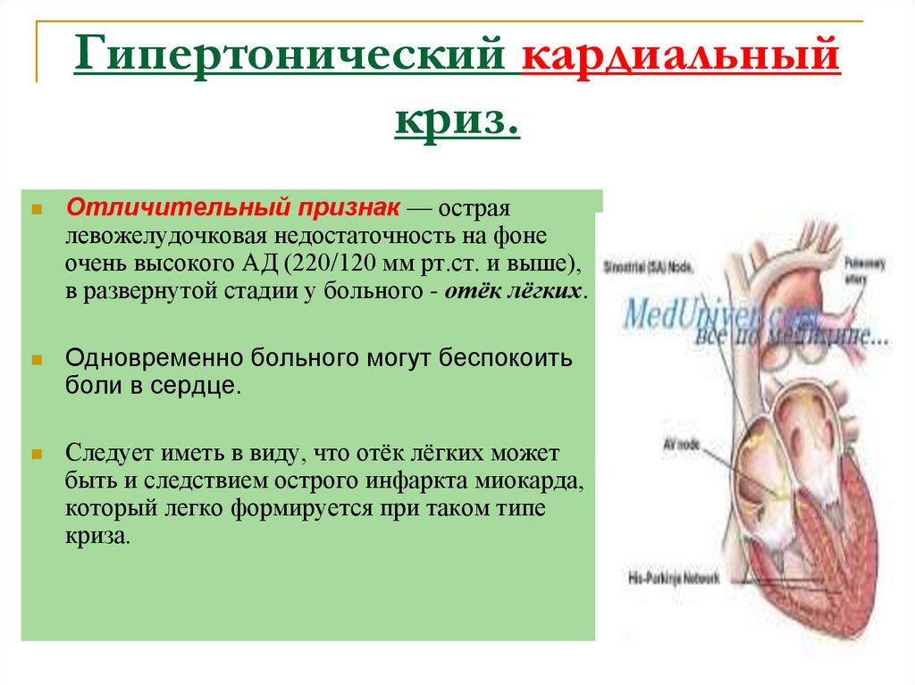 Гипертонический кардиальный криз.