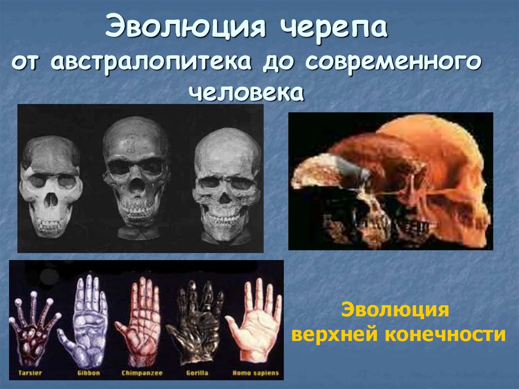 Эволюция черепа от австралопитека до современного человека