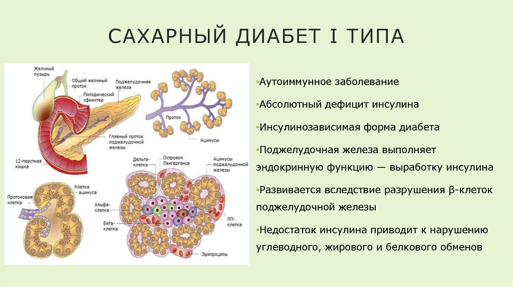 Сахарный диабет I типа