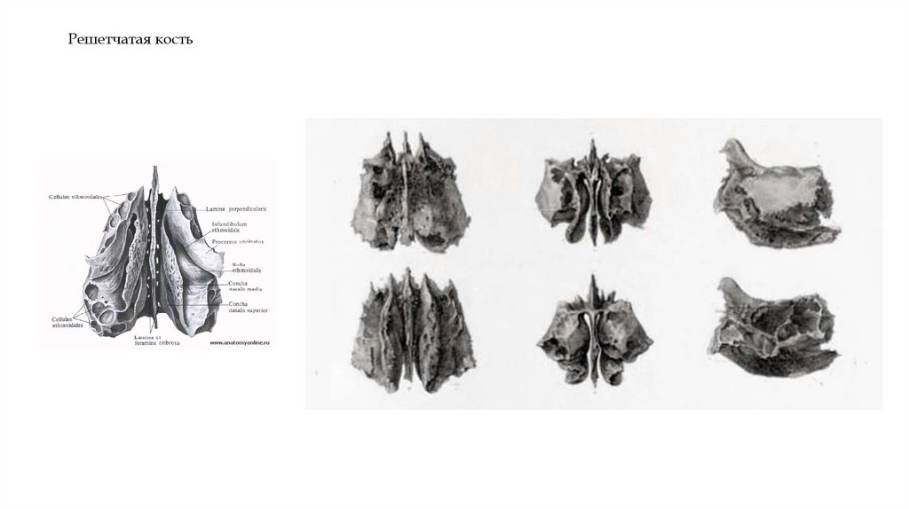 Решетчатая кость