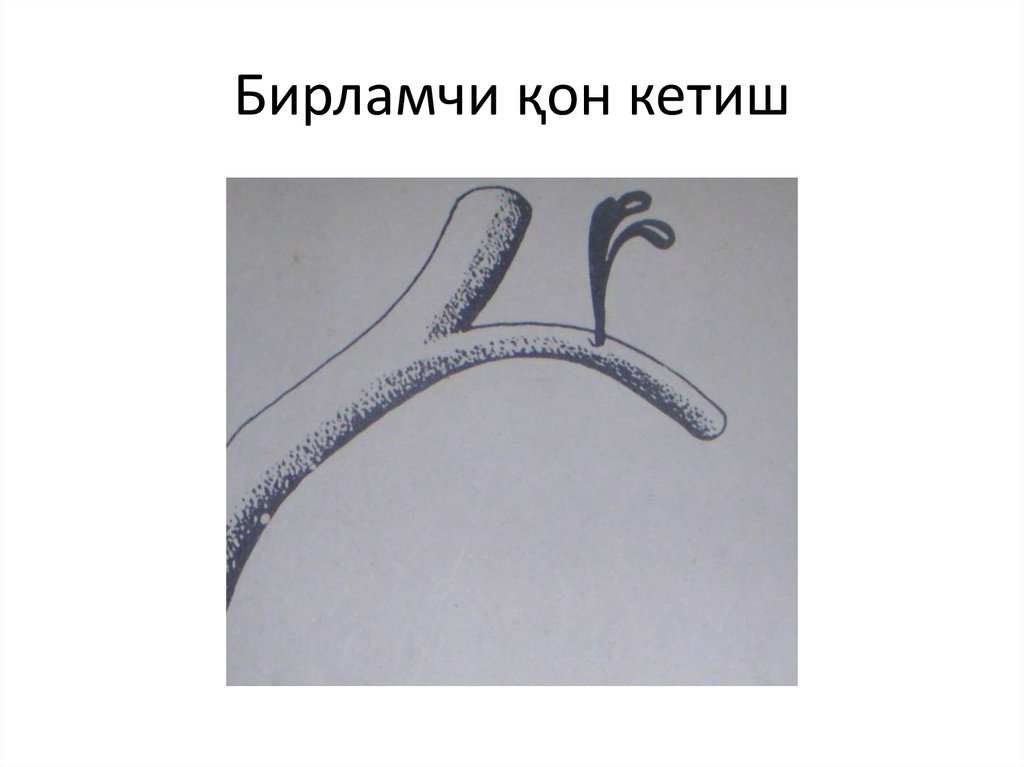 Бирламчи қон кетиш