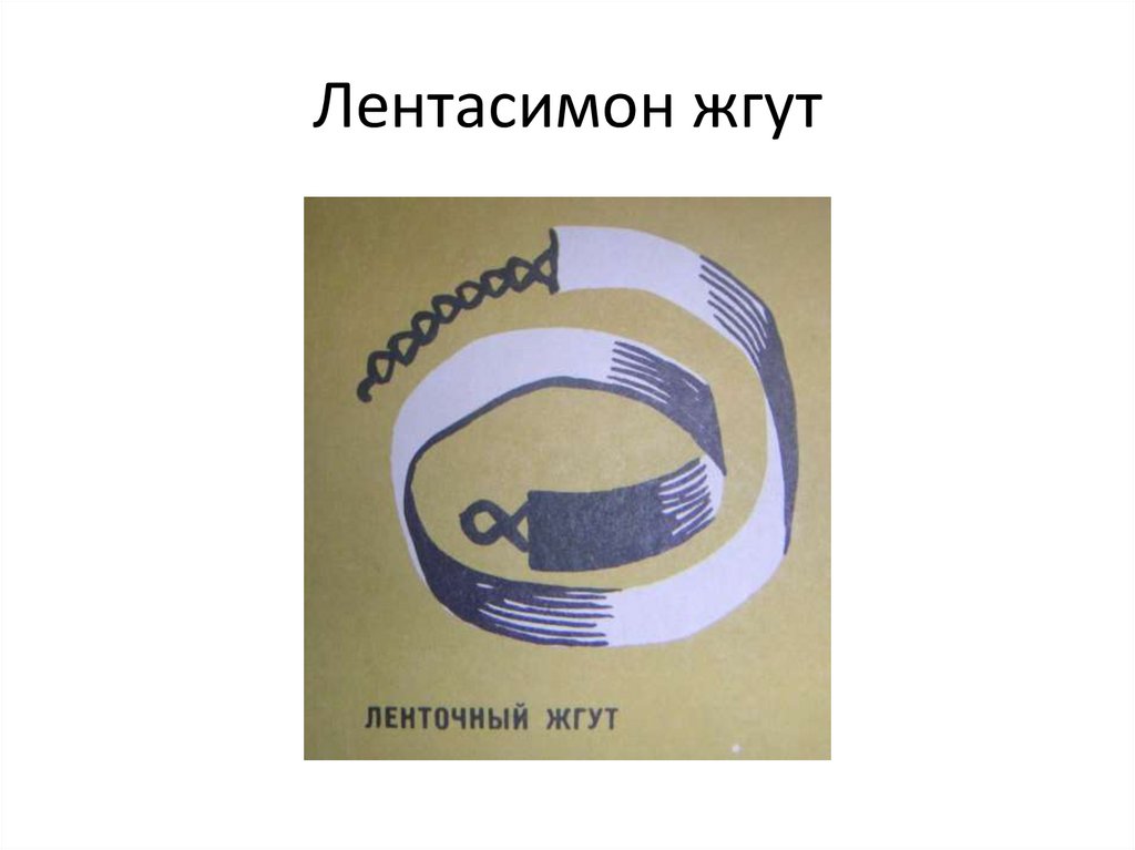 Лентасимон жгут