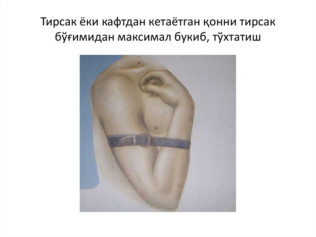 Тирсак ёки кафтдан кетаётган қонни тирсак бўғимидан максимал букиб, тўхтатиш