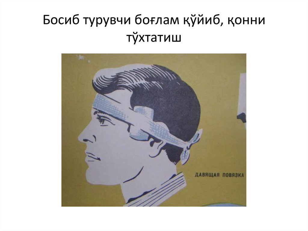 Босиб турувчи боғлам қўйиб, қонни тўхтатиш