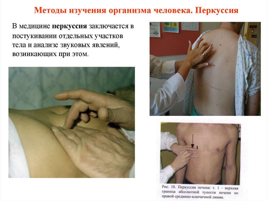 Методы изучения организма человека. Перкуссия