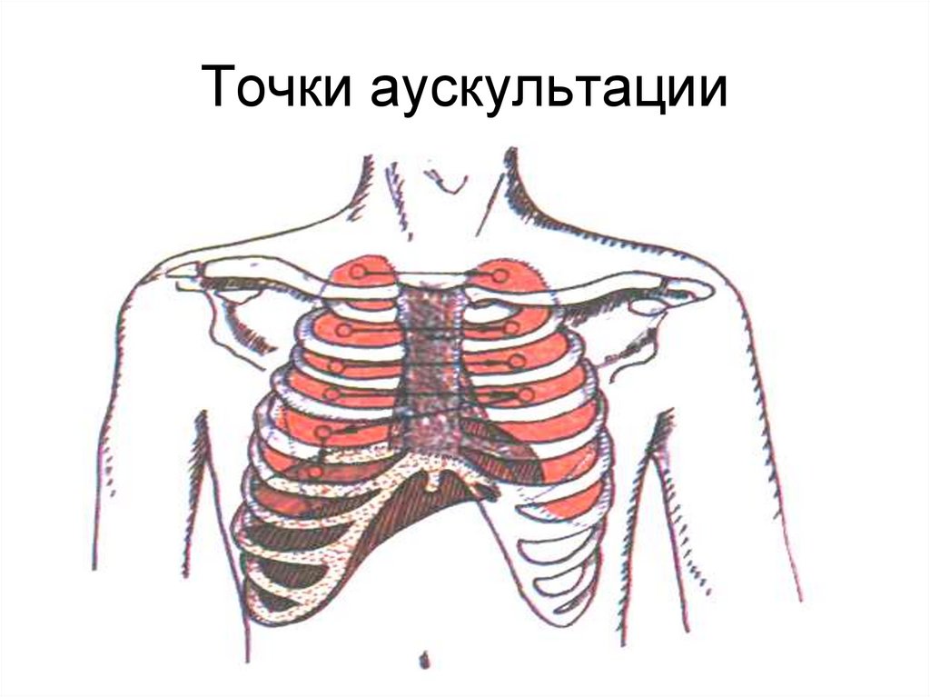 Точки аускультации