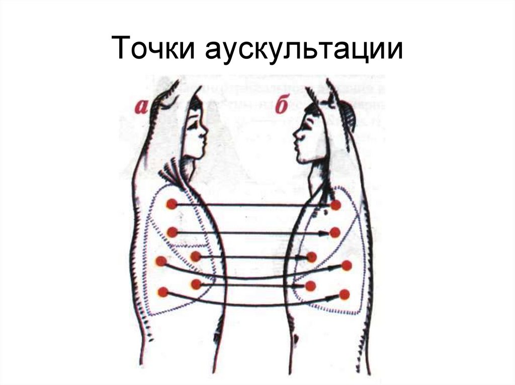 Точки аускультации