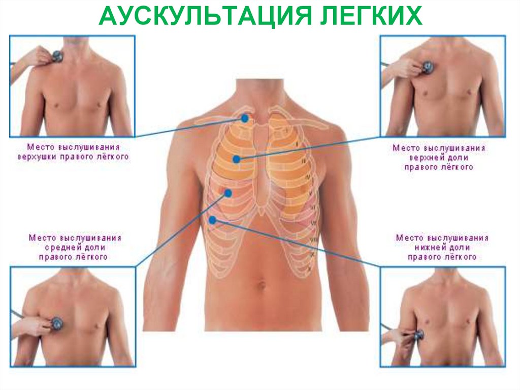 АУСКУЛЬТАЦИЯ ЛЕГКИХ