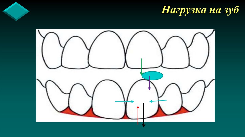 Нагрузка на зуб