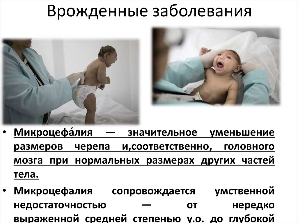 Врожденные заболевания