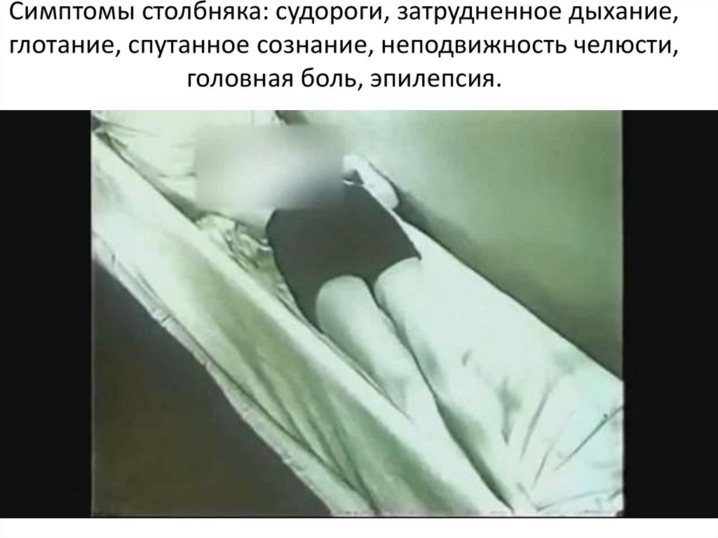 Симптомы столбняка: судороги, затрудненное дыхание, глотание, спутанное сознание, неподвижность челюсти, головная боль,