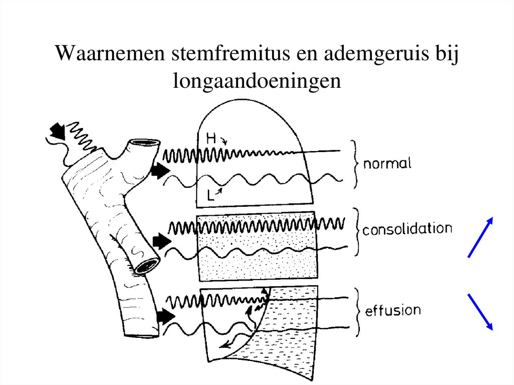 Waarnemen stemfremitus en ademgeruis bij longaandoeningen