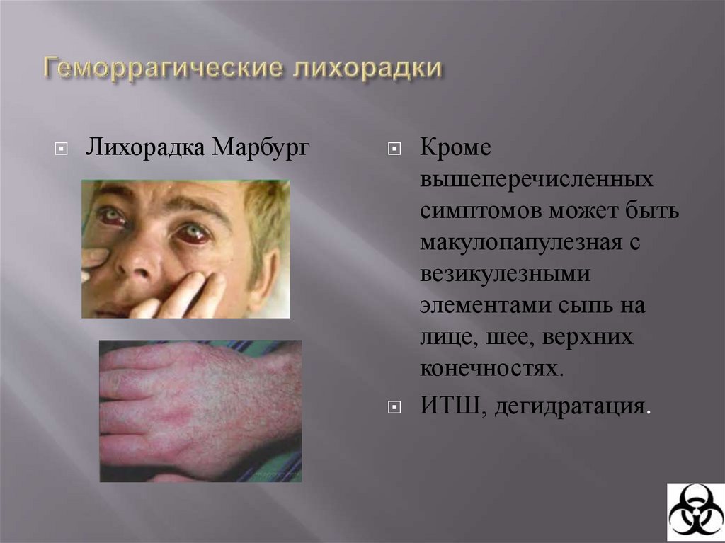 Геморрагические лихорадки.