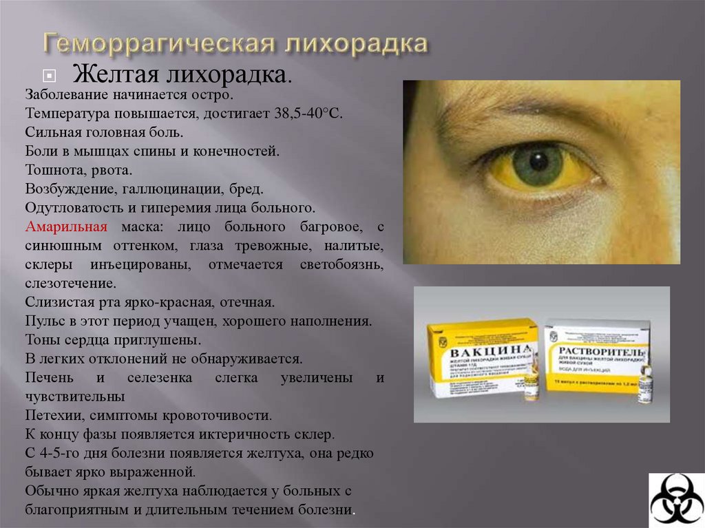 Геморрагические лихорадки