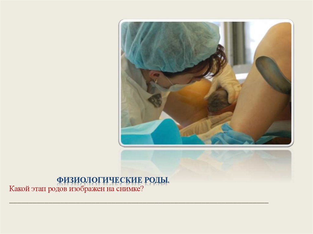Физиологические роды.