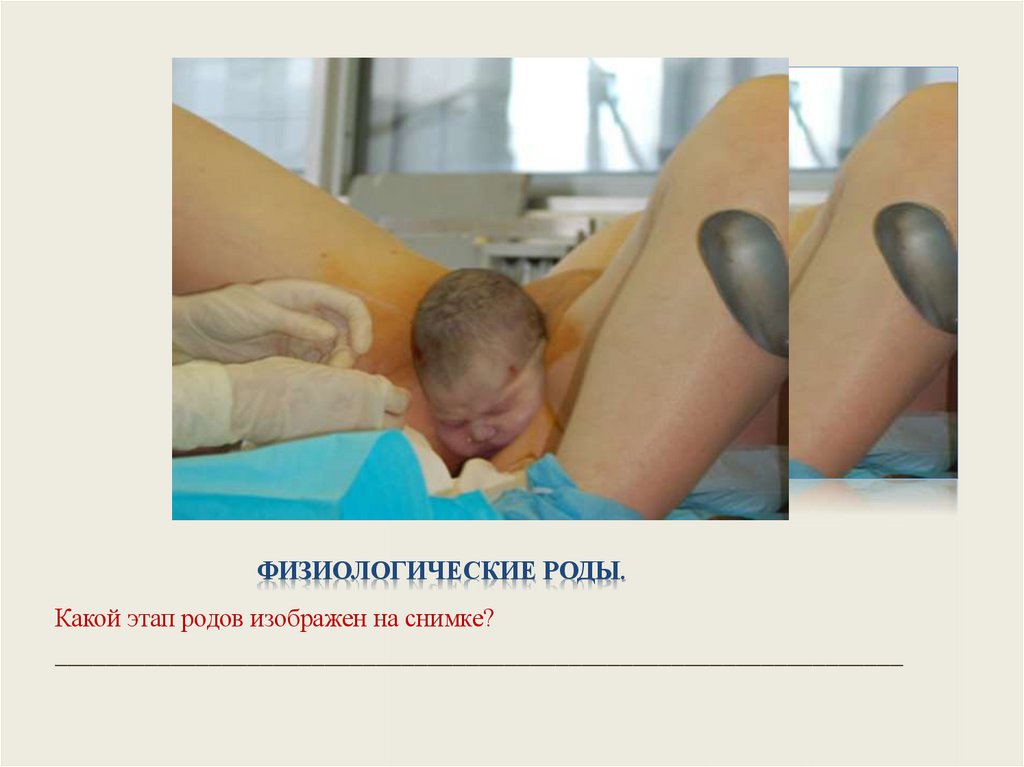 Физиологические роды.