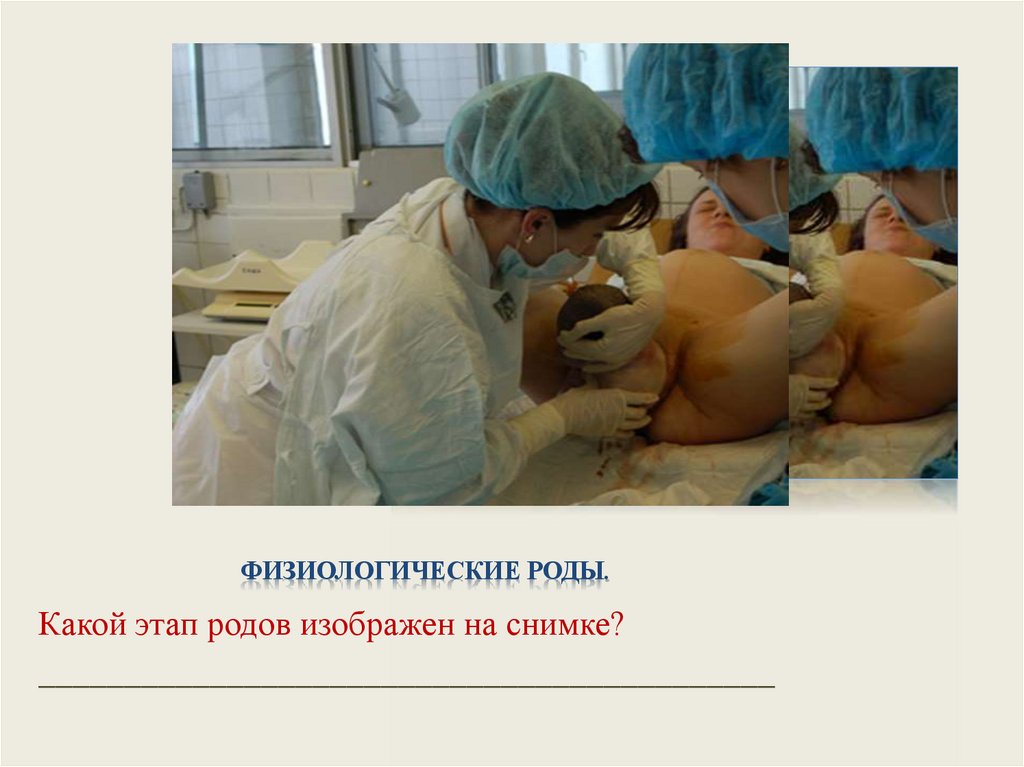 Физиологические роды.