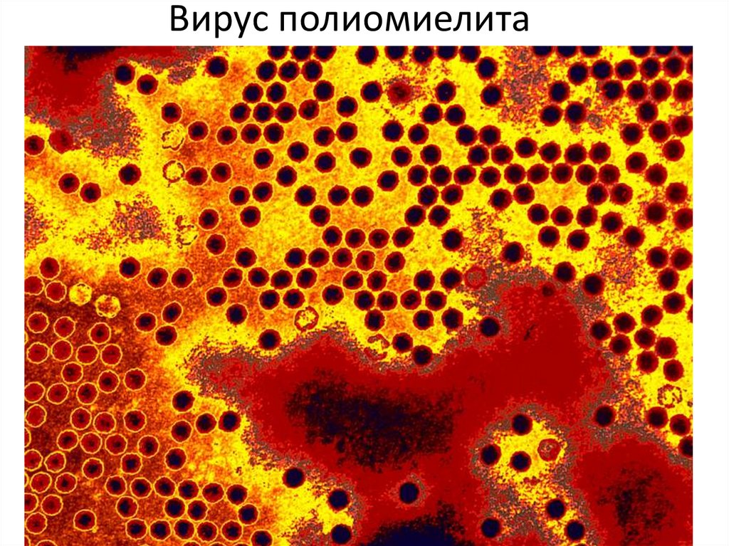 Вирус полиомиелита