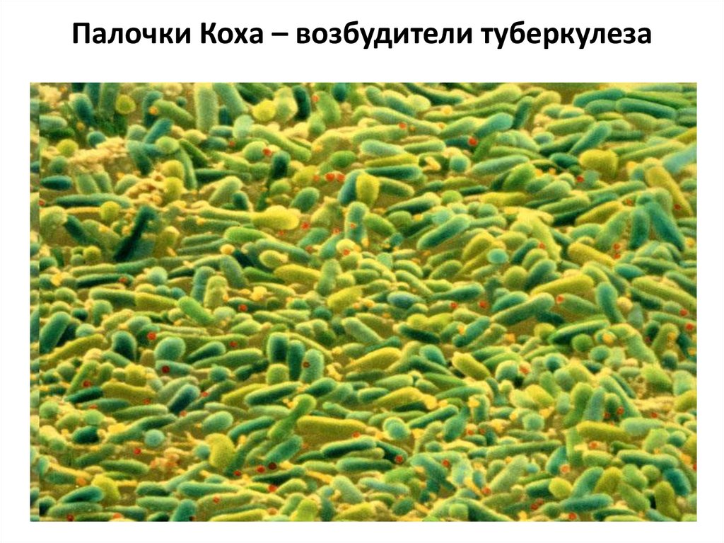 Палочки Коха – возбудители туберкулеза
