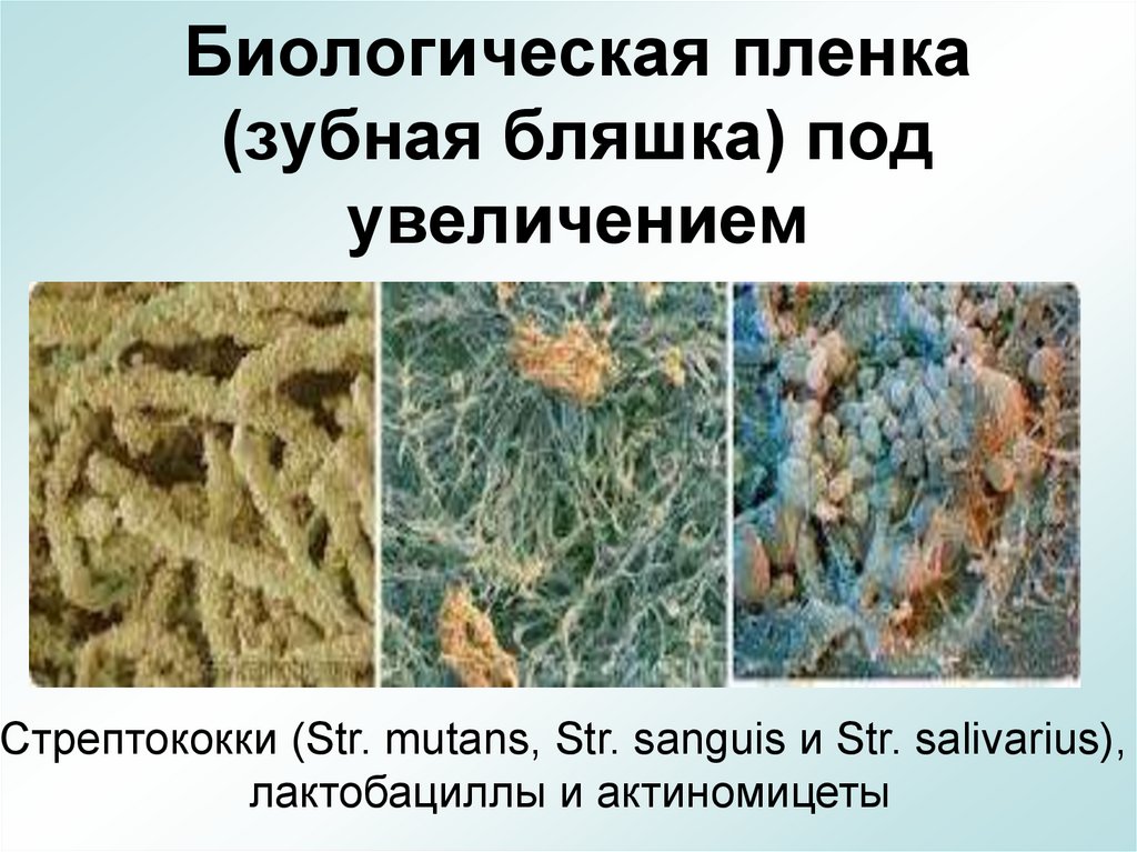 Биологическая пленка (зубная бляшка) под увеличением