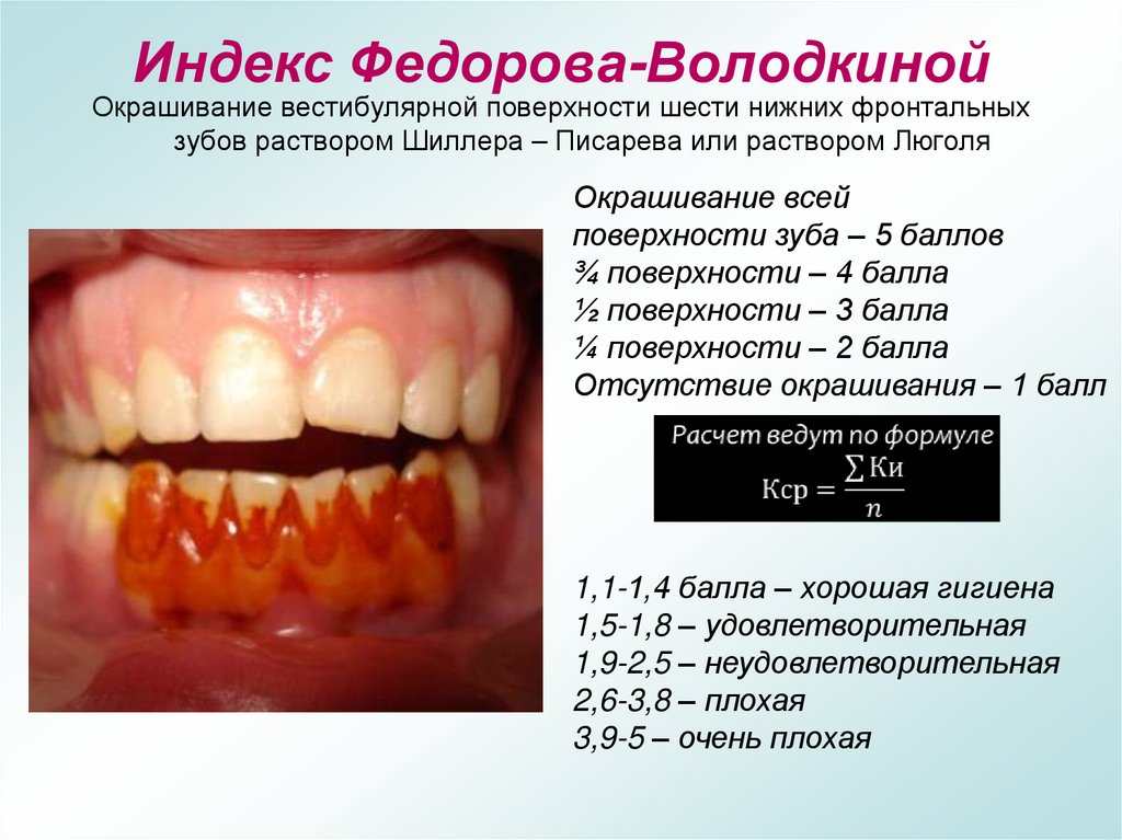 Индекс Федорова-Володкиной