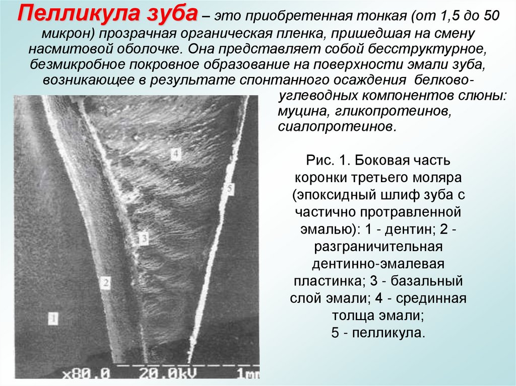 Пелликула зуба – это приобретенная тонкая (от 1,5 до 50 микрон) прозрачная органическая пленка, пришедшая на смену насмитовой