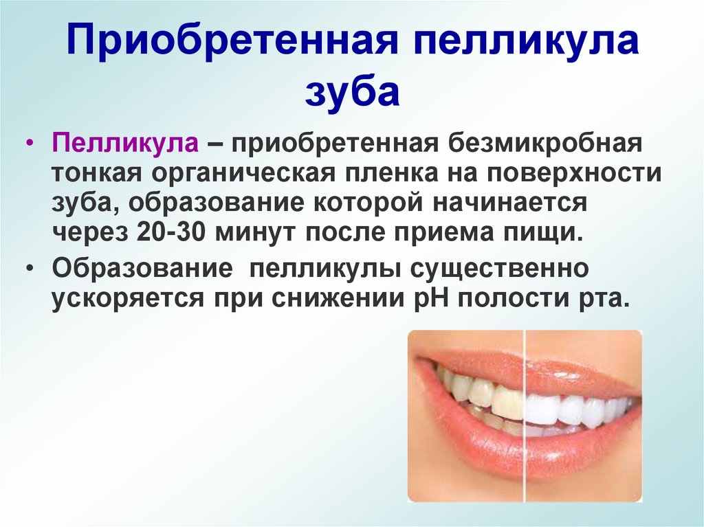 Приобретенная пелликула зуба