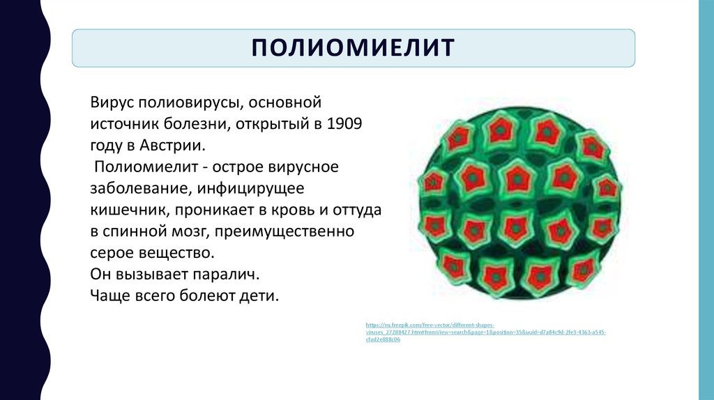 Полиомиелит