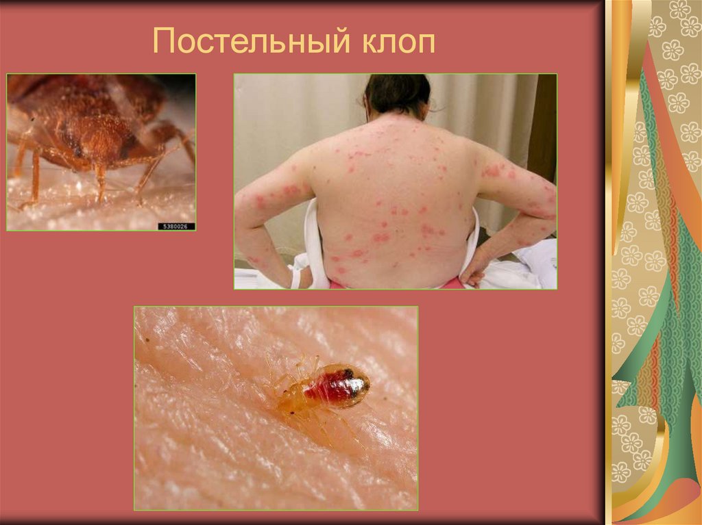 Постельный клоп