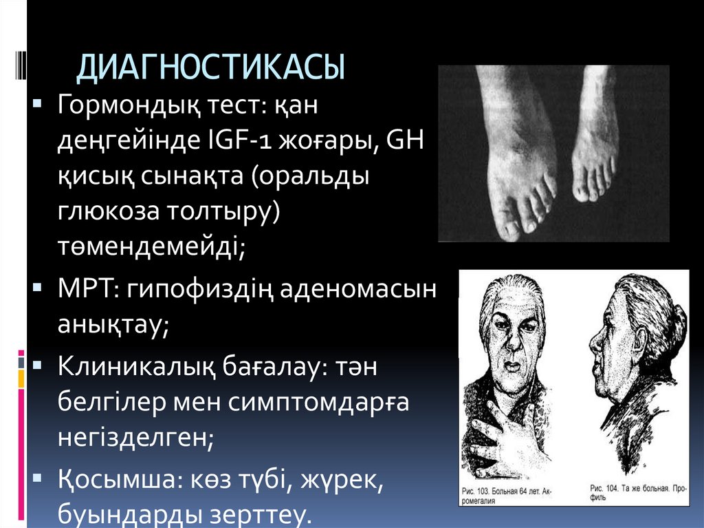 ДИАГНОСТИКАСЫ