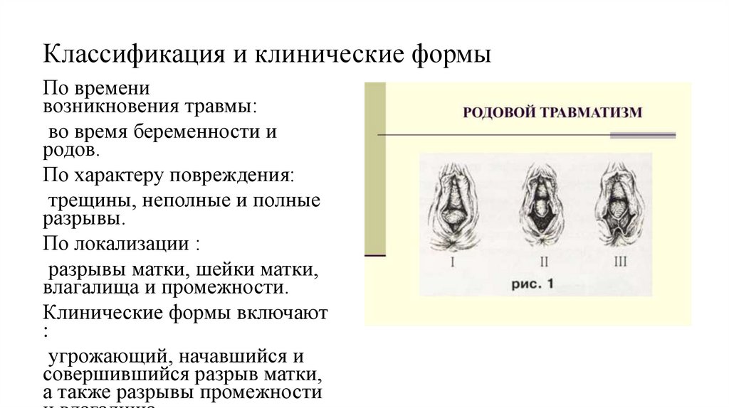 Классификация и клинические формы