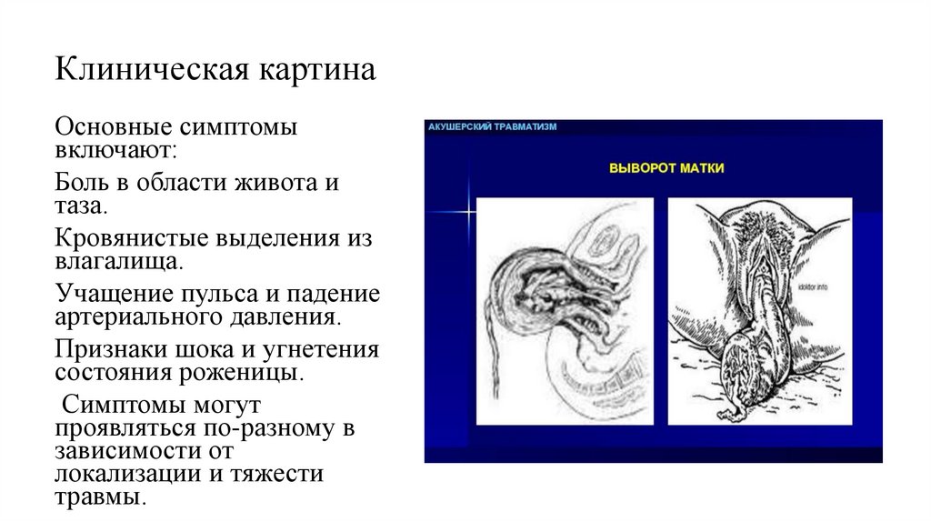 Клиническая картина