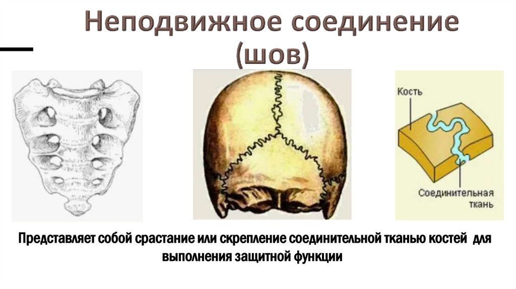 Неподвижное соединение (шов)