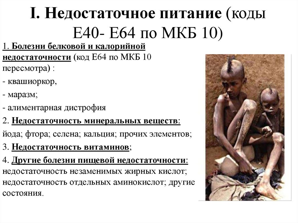 I. Недостаточное питание (коды Е40- Е64 по МКБ 10)