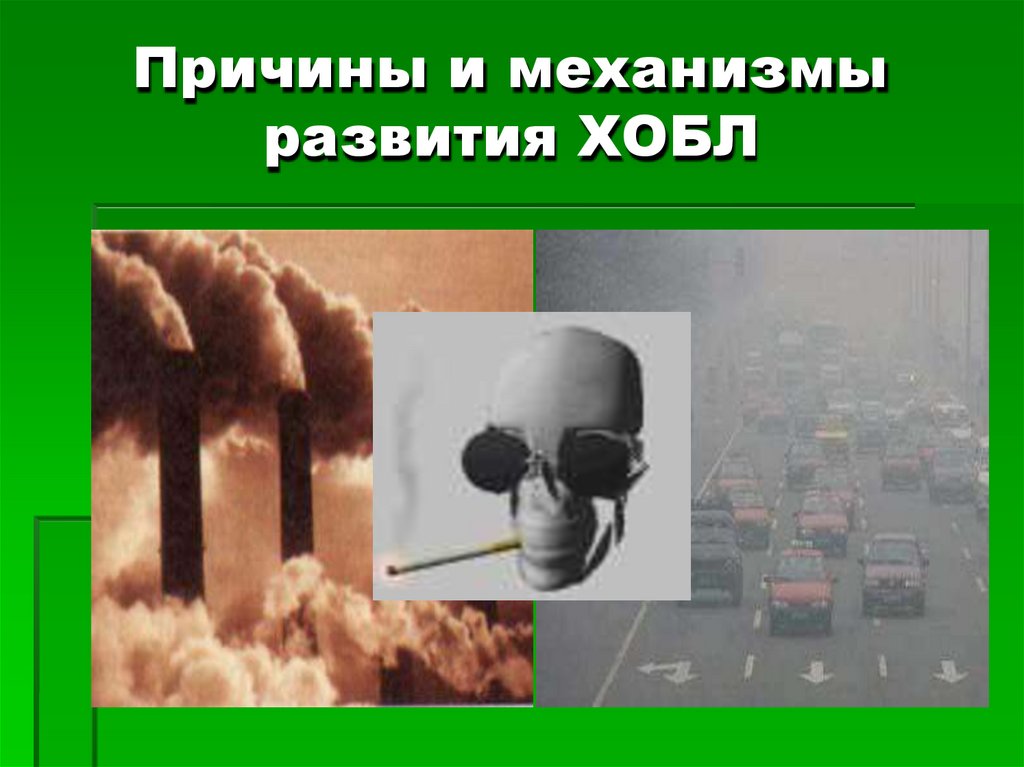 Причины и механизмы развития ХОБЛ