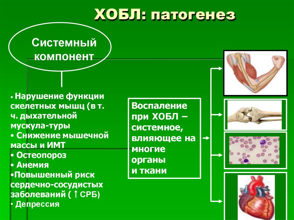 ХОБЛ: патогенез