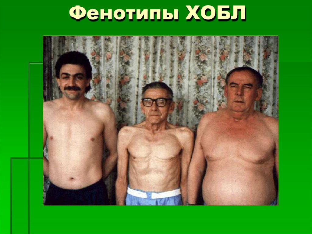 Фенотипы ХОБЛ