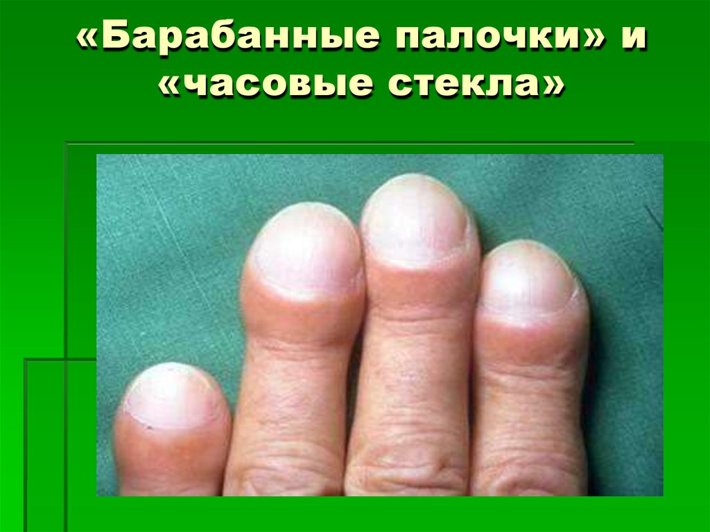 «Барабанные палочки» и «часовые стекла»