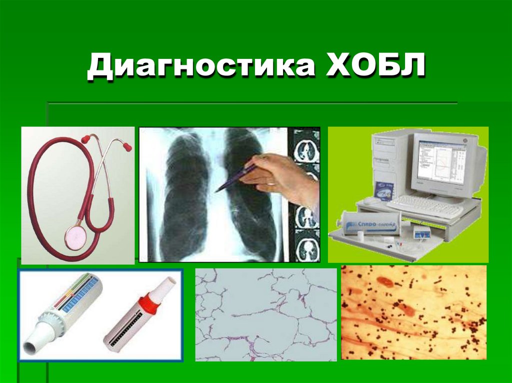 Диагностика ХОБЛ