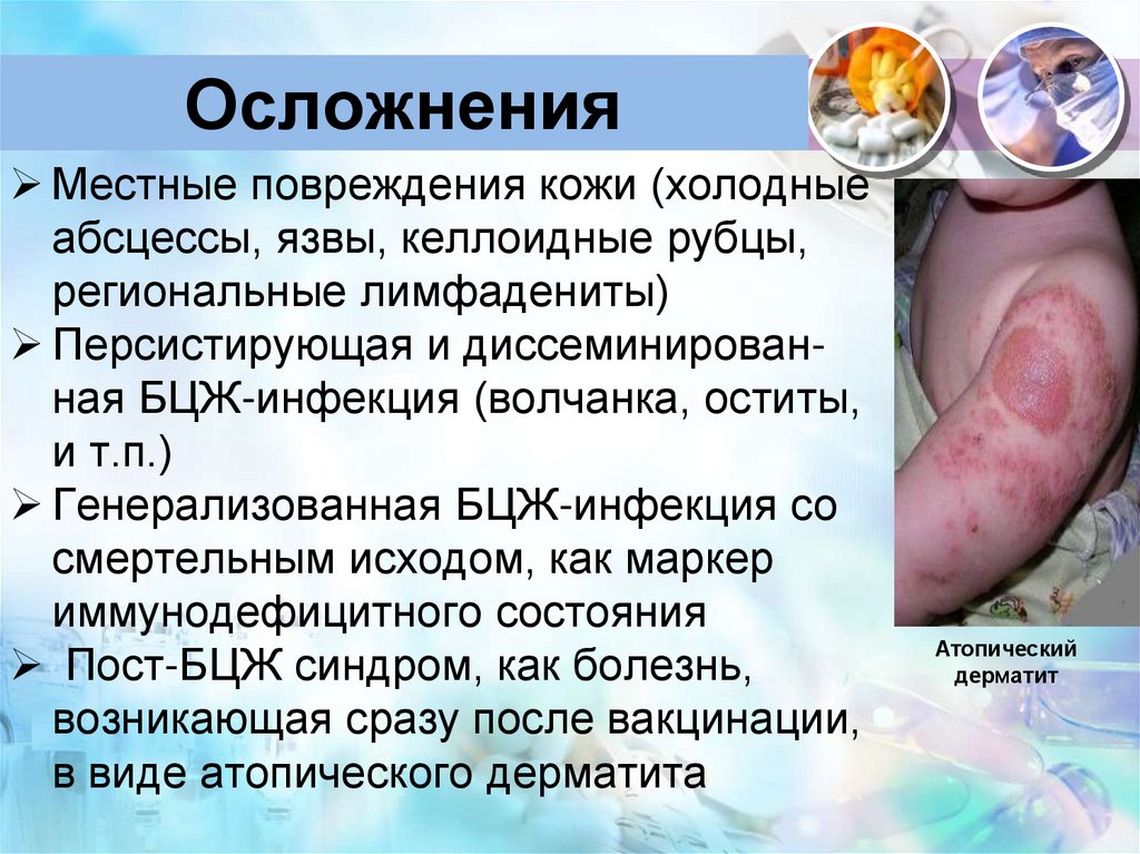 Осложнения