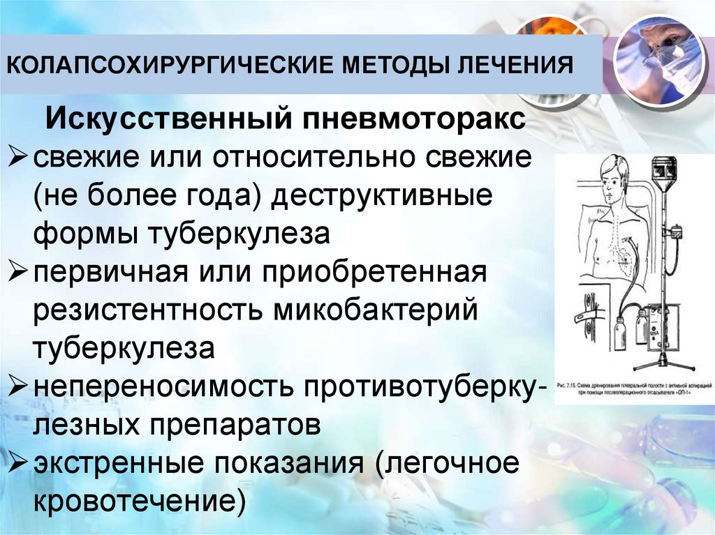 КОЛАПСОХИРУРГИЧЕСКИЕ МЕТОДЫ ЛЕЧЕНИЯ