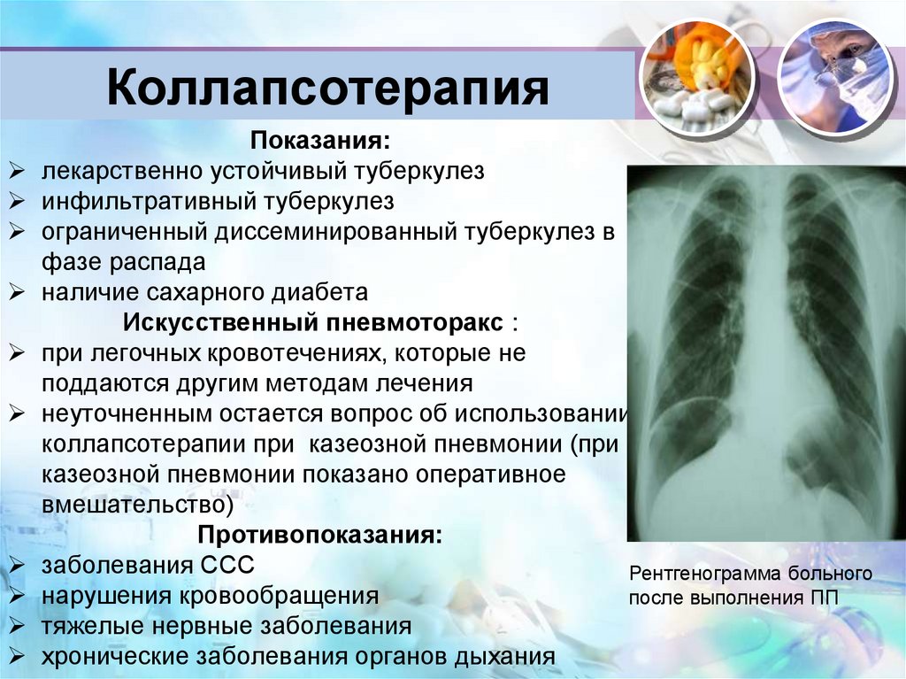 Коллапсотерапия