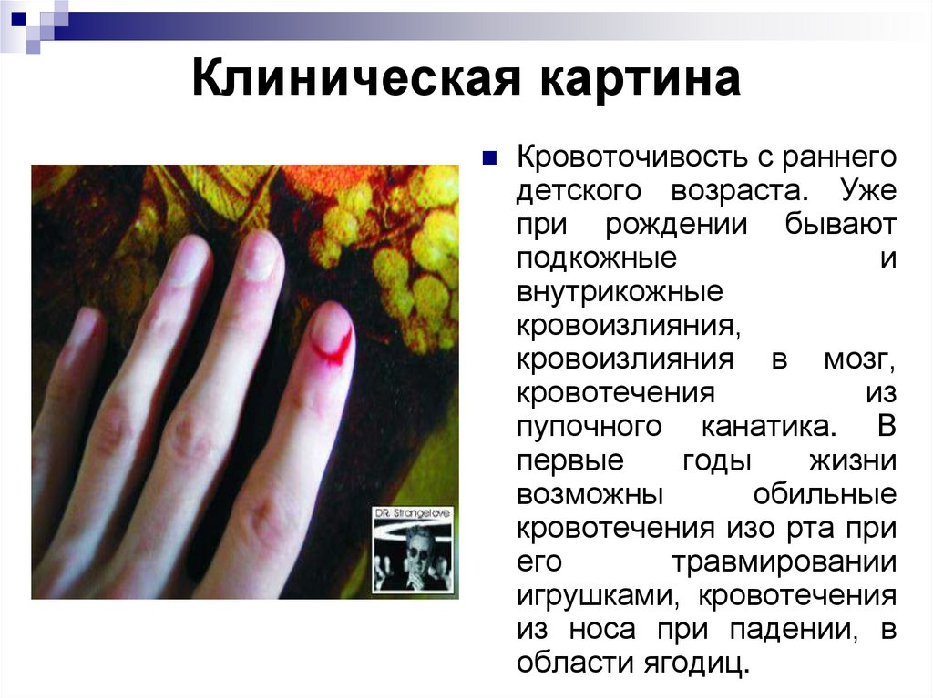 Клиническая картина