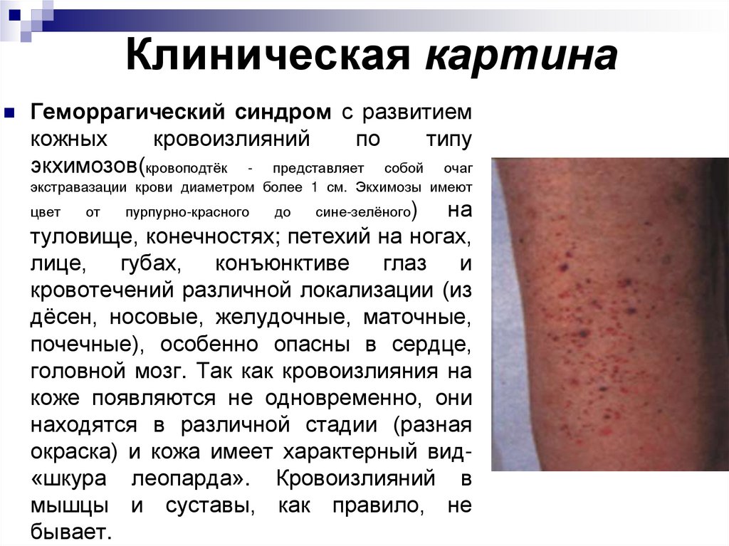 Клиническая картина